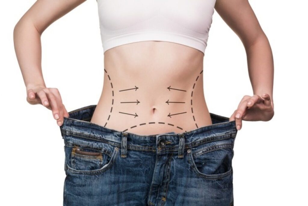 As principais diferenças entre cirurgia bariátrica e cirurgia metabólica